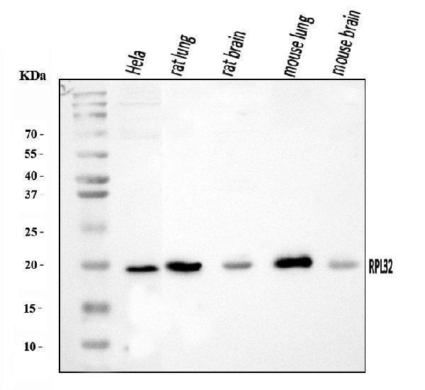  Western blot analysis of RPL32 using anti-RPL32 antibody (A06487-1)