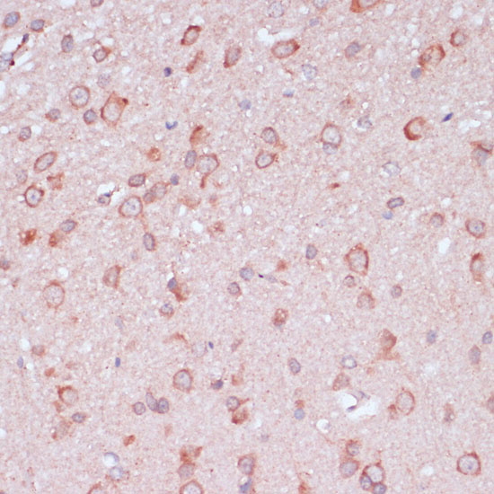 a06487 rpl32 primary antiboties ihc testing 2