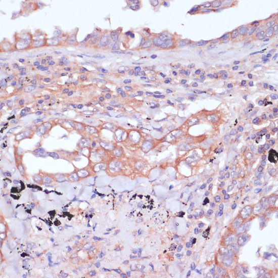 a06487 rpl32 primary antiboties ihc testing 3
