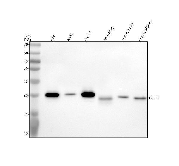 Western blot analysis of GGCT using anti-GGCT antibody (A06488-2)