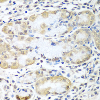 a06493 asna1 primary antiboties if testing 2