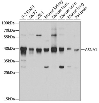 a06493 asna1 primary antiboties wb testing 1