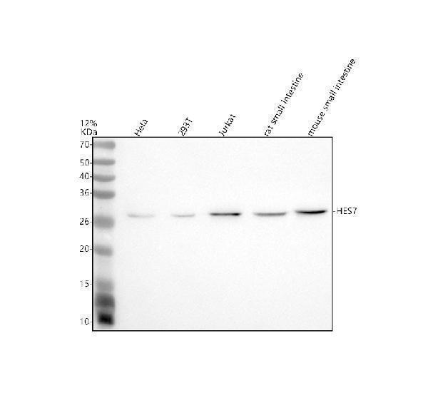 Western blot analysis of HES7 using anti-HES7 antibody (A06494-1)