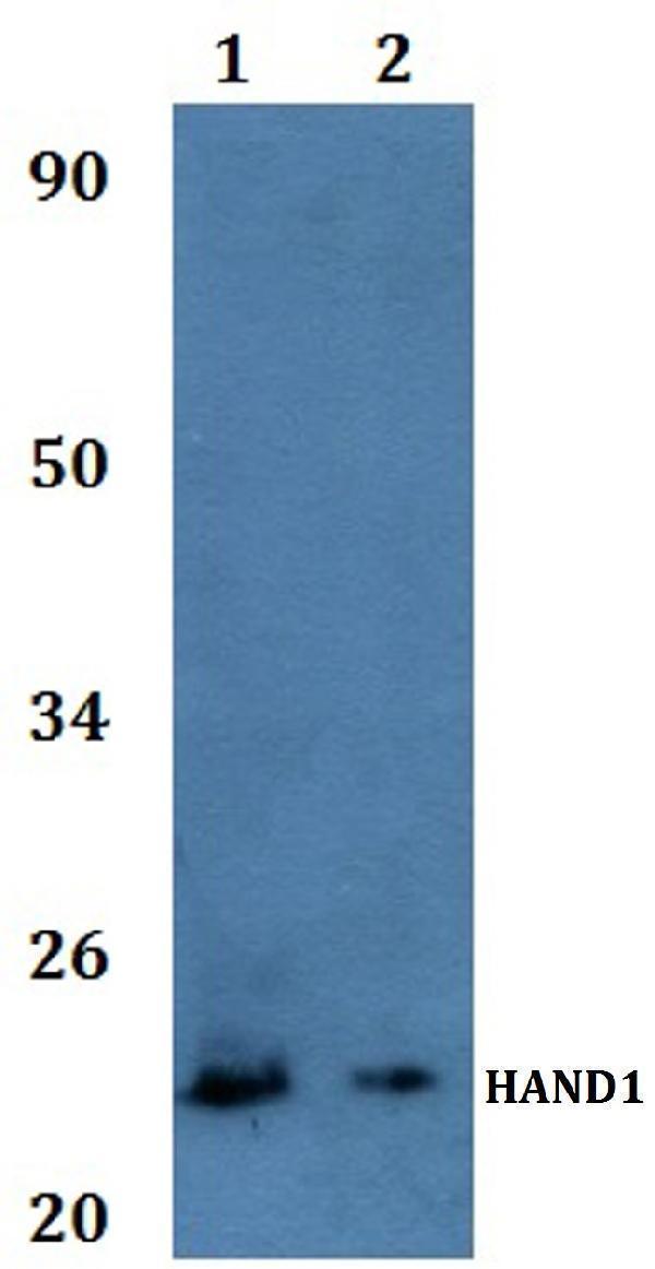 Western blot (WB) analysis of HAND1 polyclonal antibody at 1:500
Line1:Hela whole cell lysate
Line2:H9C2 whole cell lysate
Line3: