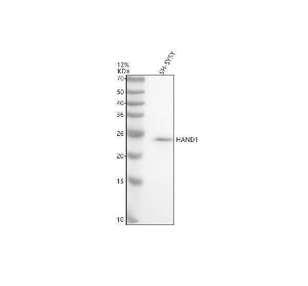  Western blot analysis of HAND1 using anti-HAND1 antibody (A06496-3)
