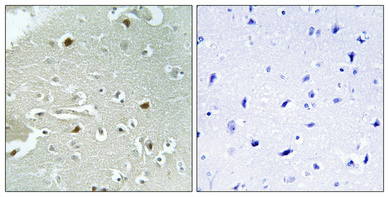 Immunohistochemistry validation of HAND1 using Anti-Phospho-HAND1 (S98) Antibody (A06496S98)
