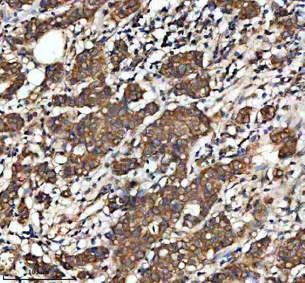 IHC analysis of GTSE1 using anti-GTSE1 antibody (A06497-2)