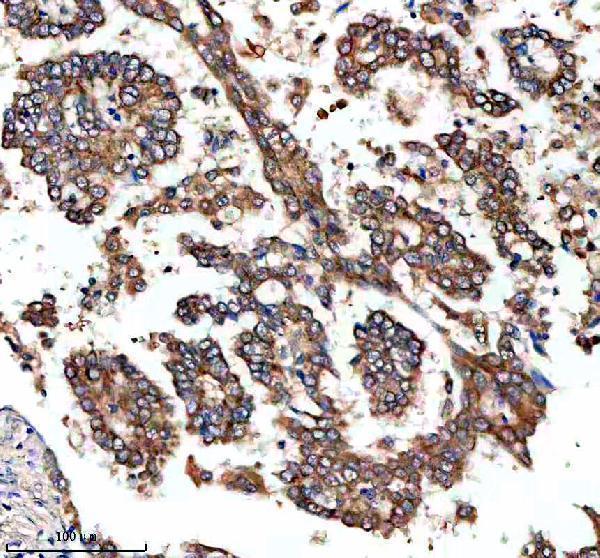 IHC analysis of GTSE1 using anti-GTSE1 antibody (A06497-2)