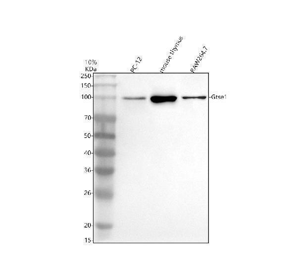 Western blot analysis of GTSE1 using anti-GTSE1 antibody (A06497-3)