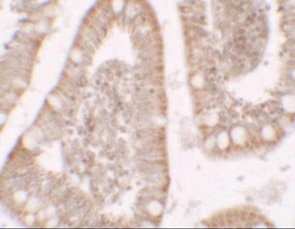 a06498 rc3h1 primary antibodies ihc testing 2
