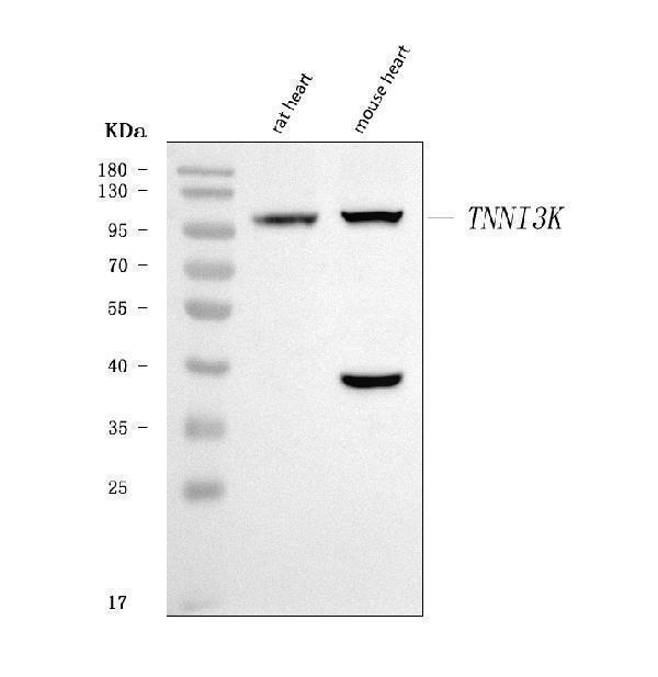  Western blot analysis of TNNI3K using anti-TNNI3K antibody (A06499-2)