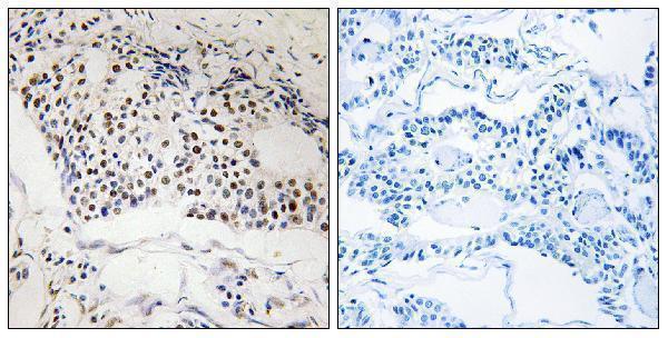 a06500 mysm1 primary antibodies ihc testing 1