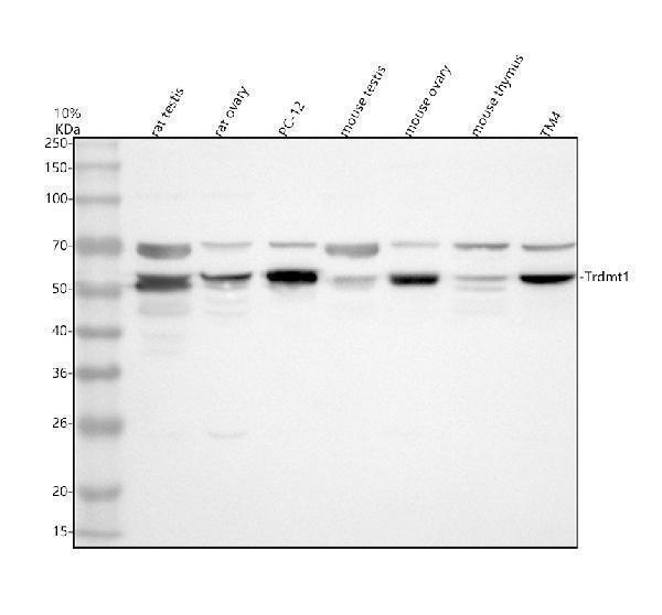 Western blot analysis of DNMT2/TRDMT1 using anti-DNMT2/TRDMT1 antibody (A06504-1)