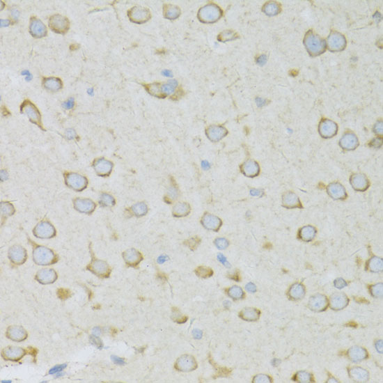 a06505 rpl13 primary antiboties ihc testing 2