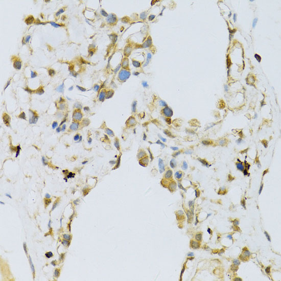 a06505 rpl13 primary antiboties ihc testing 4