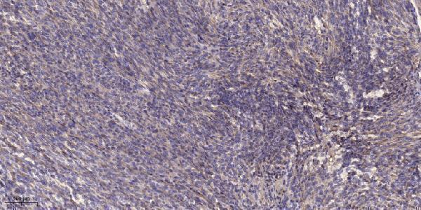a06507 1 cdk10 primary antibodies ihc testing 1