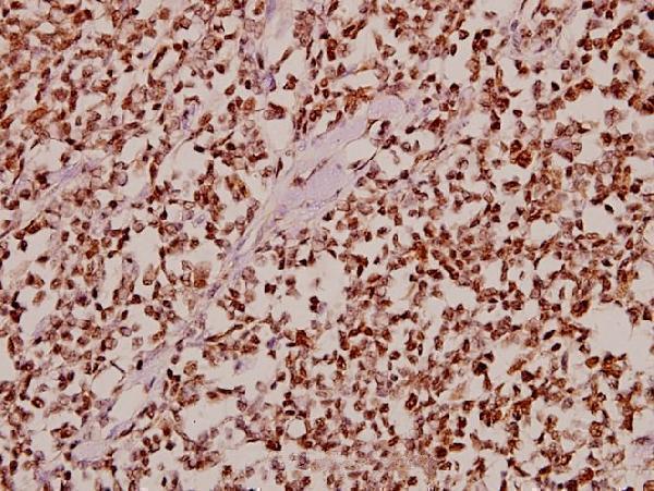 a06507 cdk10 primary antiboties ihc testing 2