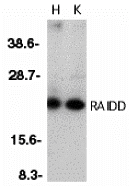 a06509 1 cradd primary antibodies wb testing 1