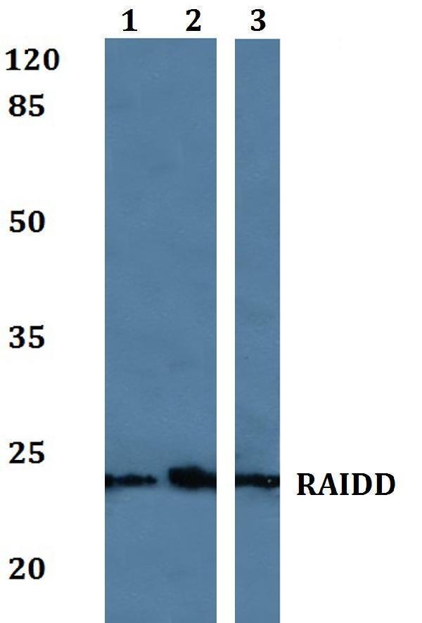 a06509 2 cradd primary antiboties wb testing 1