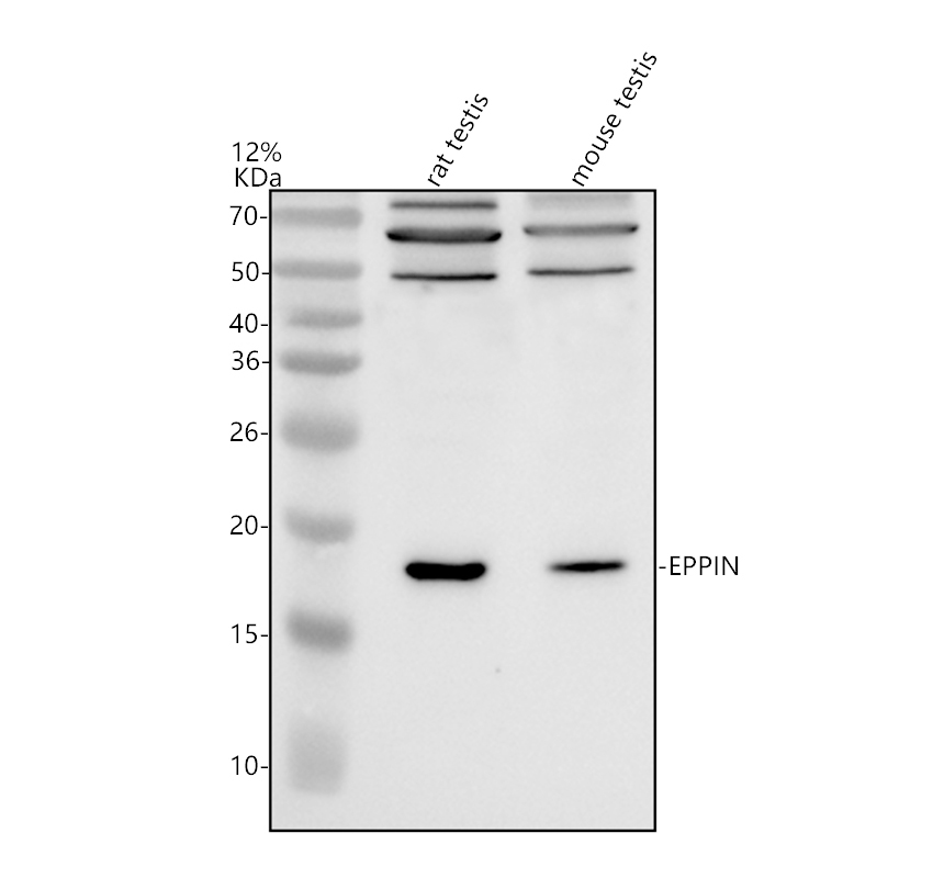 a06512 eppin primary antibodies wb testing 1