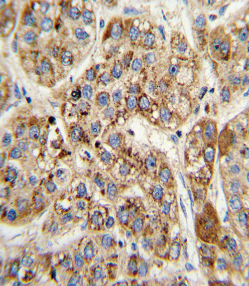 a06515 1 anti mccc2 antibody center ihc p testing 2