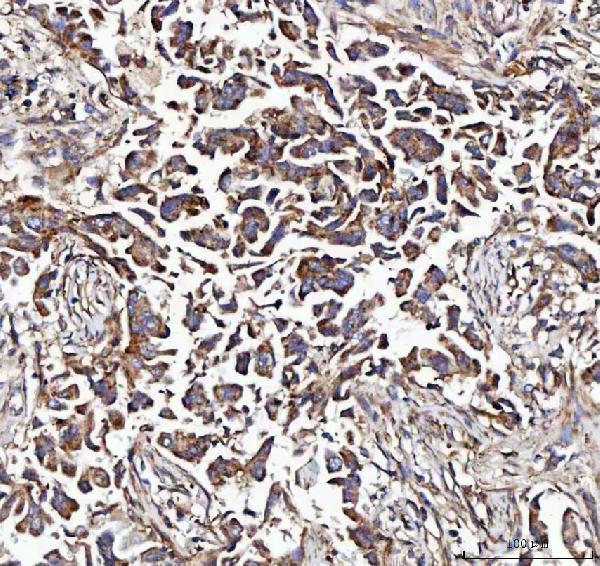  IHC analysis of MCCC2 using anti-MCCC2 antibody (A06515-2)