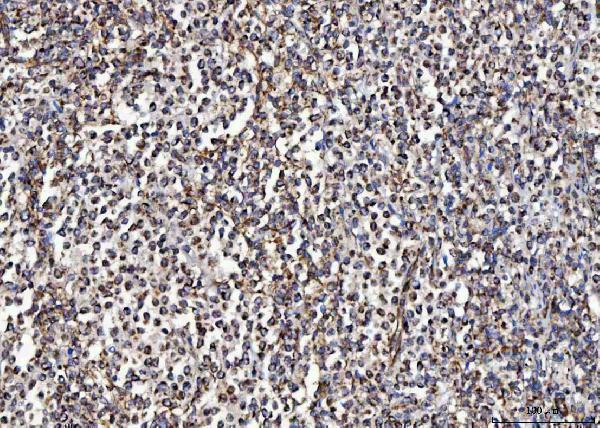  IHC analysis of MCCC2 using anti-MCCC2 antibody (A06515-2)