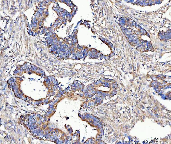 a06515 2 mccc2 primary antibodies ihc testing 5