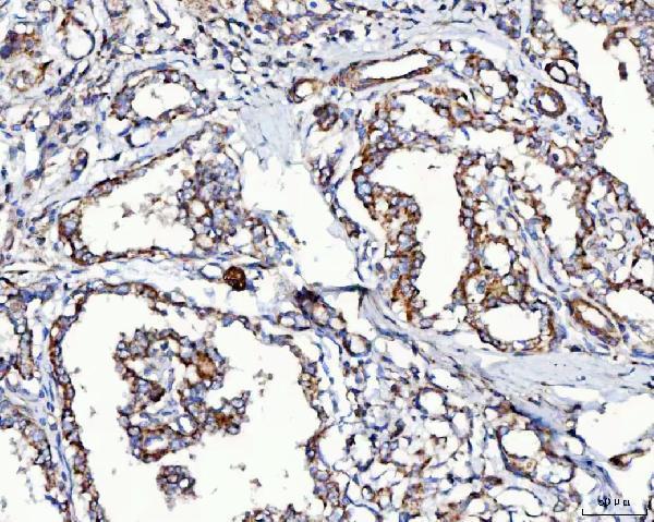 a06515 2 mccc2 primary antibodies ihc testing 6
