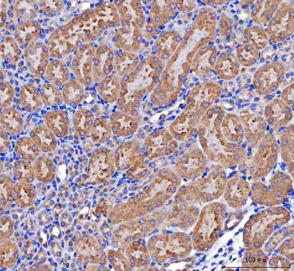 a06515 2 mccc2 primary antibodies ihc testing 7