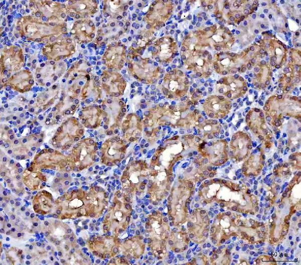 a06515 2 mccc2 primary antibodies ihc testing 8