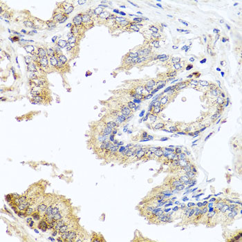 a06515 mccc2 primary antiboties ihc testing 2
