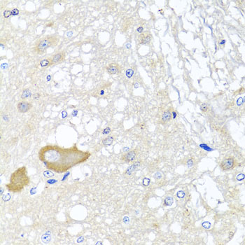 a06515 mccc2 primary antiboties ihc testing 3