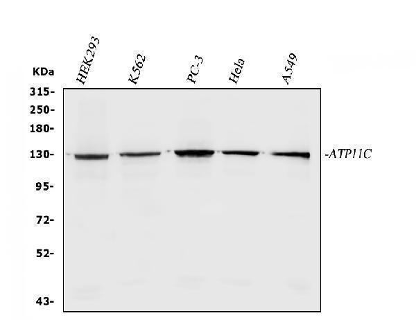  Western blot analysis of ATP11C using anti-ATP11C antibody (A06516-1)