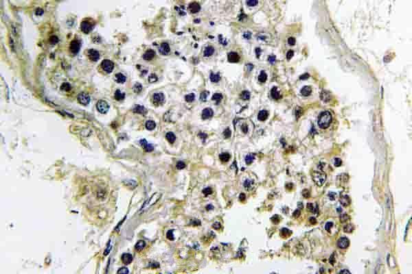a06518t2 gnat2 primary antiboties ihc testing 2