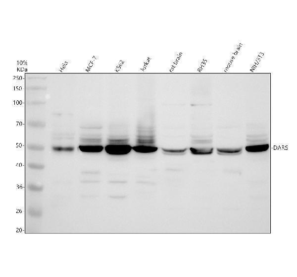 Western blot analysis of DARS using anti-DARS antibody (A06519-2)