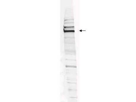 Western blot analysis is shown using Boster's Affinity Purified anti-Human WHIP antibody to detect Human WHIP present in a HEK293 whole cell lysate