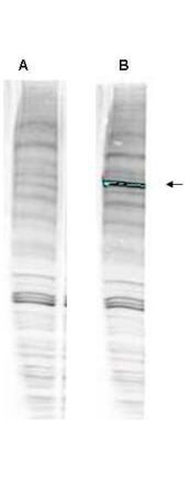 Western blot analysis is shown using Boster