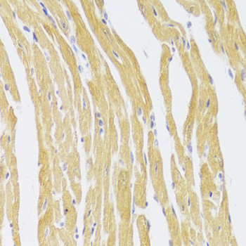 Immunohistochemistry of paraffin-embedded mouse heart using CSRP3 Antibody  at dilution of 1:100 