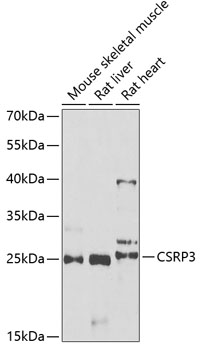 Western blot analysis of extracts of various cell lines, using CSRP3 antibody  at 1:1000 dilution