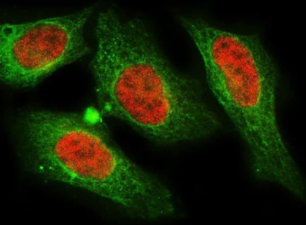  IF analysis of MNAT1 using anti-MNAT1 antibody (A06523) and anti-Beta Tubulin antibody (M01857-3)