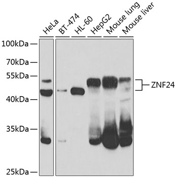 a06529 1 znf24 primary antiboties wb testing 1