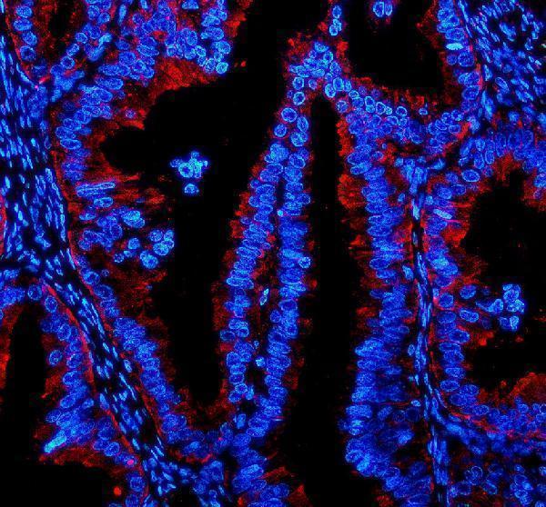 a06531 1 pgrmc2 primary antibodies if testing 1