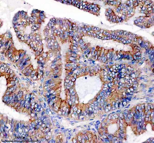 IHC analysis of PGRMC2 using anti-PGRMC2 antibody (A06531-1)
