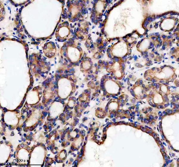 IHC analysis of PGRMC2 using anti-PGRMC2 antibody (A06531-1)