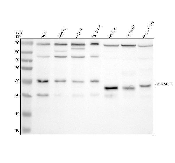 Western blot analysis of PGRMC2 using anti-PGRMC2 antibody (A06531-1)