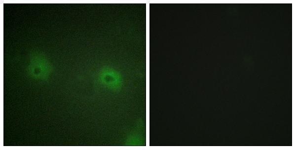 Immunofluorescence analysis of HUVEC cells, using STAM2 Antibody