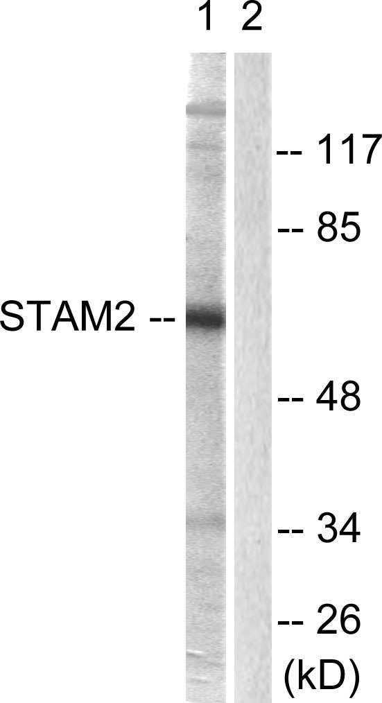 Western blot analysis of lysates from NIH/3T3 cells, treated with EGF 200ng/ml 30', using STAM2 Antibody