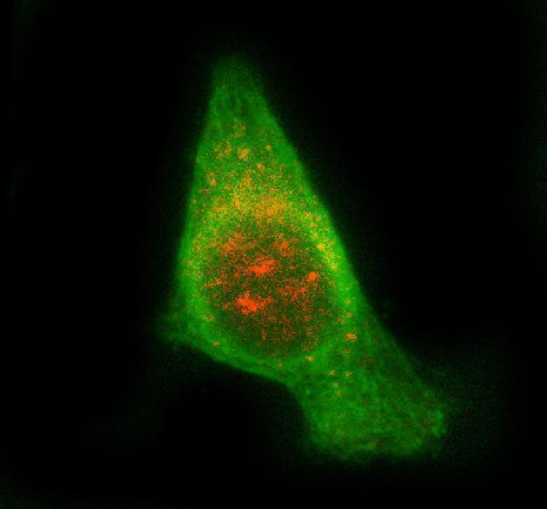  IF analysis of STAM2 using anti-STAM2 antibody (A06533-3) and anti-Beta Tubulin antibody (M01857-3)