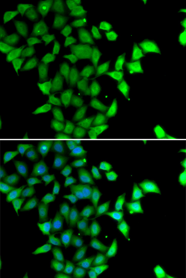 a06533 stam2 primary antiboties if testing 3